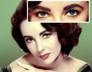 Liz Taylor distichiasis